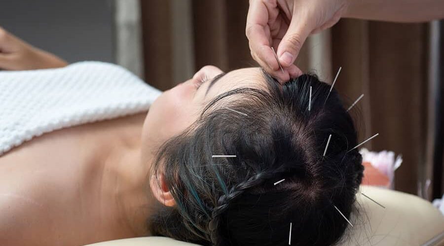 acupuncture programs Admissions